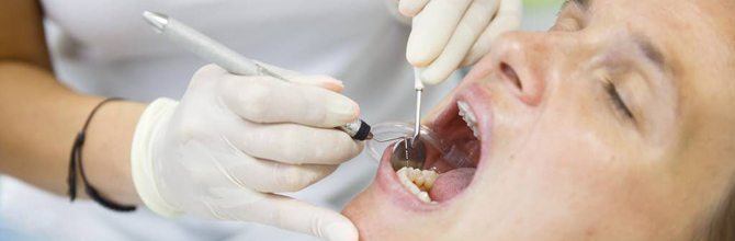 Endodoncia dentista peligros